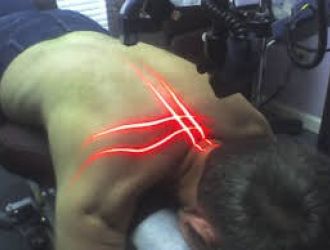 Cold Laser Therapy
